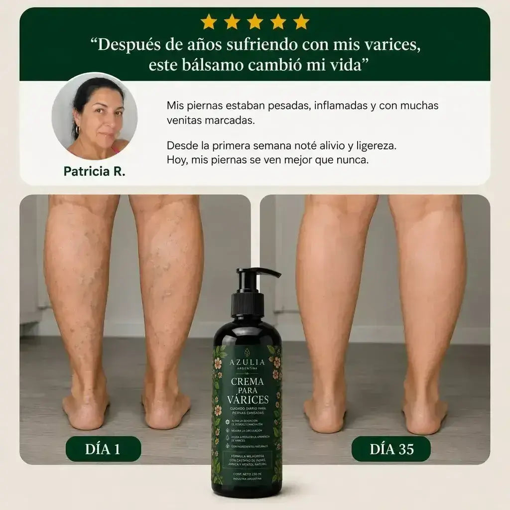 Crema Anti-Várices AZULIA™ 5 en 1 | Circulación, Hinchazón y Piernas Cansadas